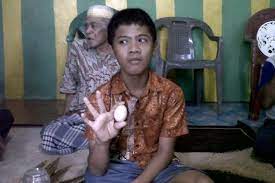Indonesia: Cậu bé biết "đẻ" trứng khiến bác sĩ bó tay